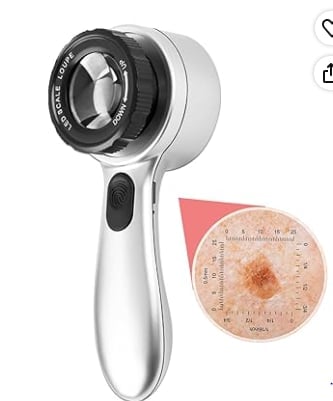 Handheld skin analysis device with white handle and black lens, displayed next to a magnified skin lesion sample for comparison